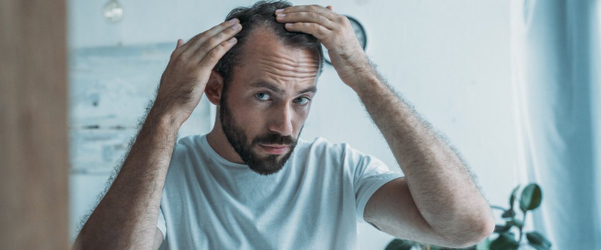 mid adult man with alopecia looking at mirror, hair loss concept